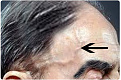 اضغط على الصورة لعرض أكبر. 

الإسم:	Temporal-Arteritis.jpg 
مشاهدات:	0 
الحجم:	23.1 كيلوبايت 
الهوية:	1282200